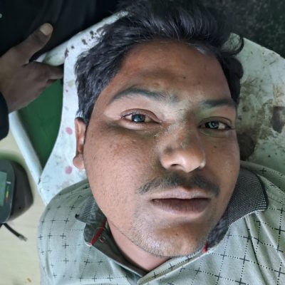 उझानी -भाजपा मंडल सयोजक के प्रधान पति ने मारी गोली ,भाजपा मंडल सयोजक गंभीर घायल जिला अस्पताल रेफर