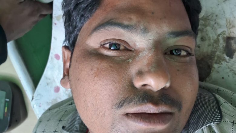 उझानी -भाजपा मंडल सयोजक के प्रधान पति ने मारी गोली ,भाजपा मंडल सयोजक गंभीर घायल जिला अस्पताल रेफर